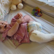 10 things to remember if your child breaks a bone and you are nowhere near a hospital