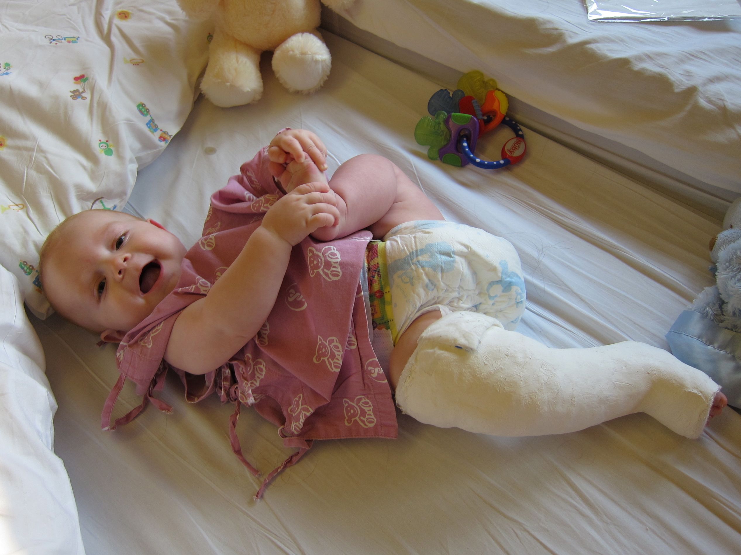 10 Things To Remember If Your Child Breaks A Bone And You Are Nowhere